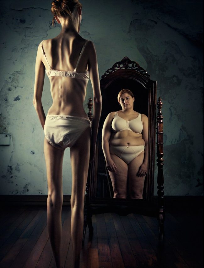 Anoreksija